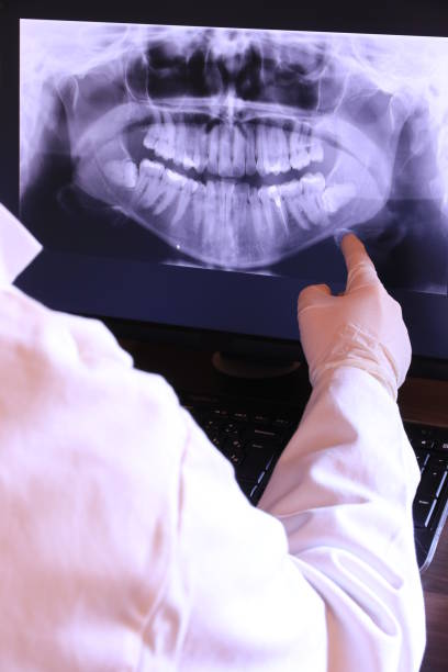 Best Emergency Root Canal Therapy in Poplarville, MS