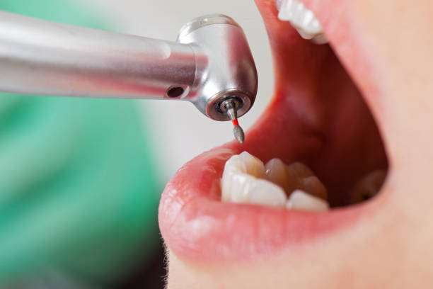 Best Emergency Denture Repair in Poplarville, MS
